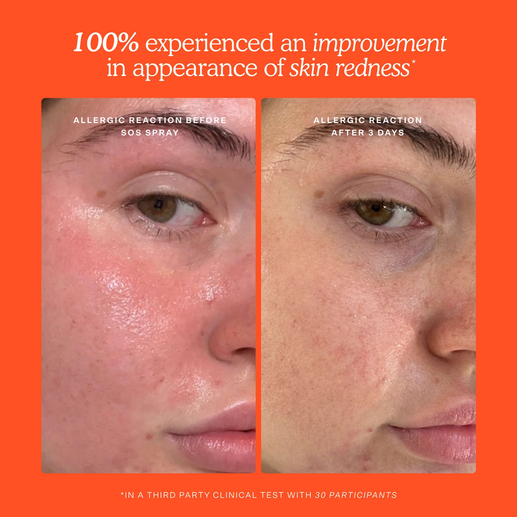 Before and after comparison of skin redness with a clinical test result on an orange background. [Shared]